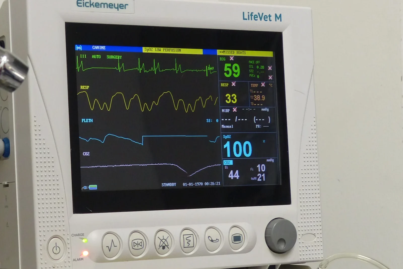 Überwachungsmonitor zur Kontrolle der Vitalwerte während einer Narkose.